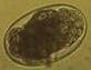 Oval microscopic egg with thin shell and dark granular internal contents