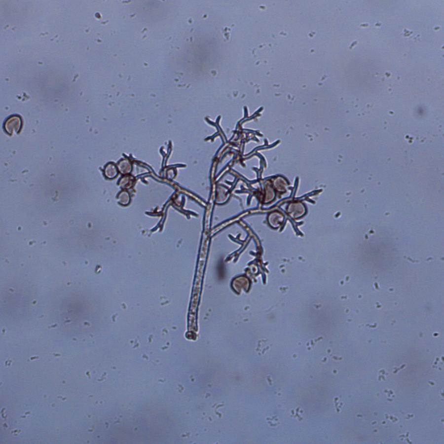 Figure 1: Sporangiophore and sporangia of Peronospora belbahrii (Saunia Withers, NCSU Vegetable Pathology Lab)