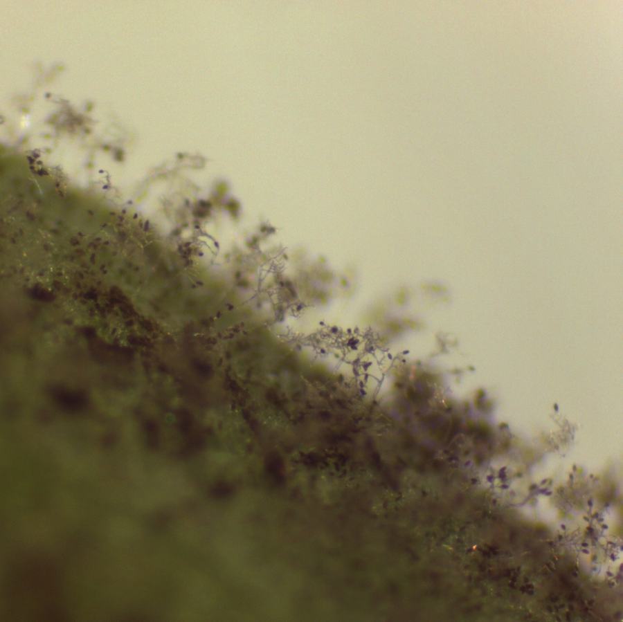 Figure 4: Peronospora belbahrii sporangiophores bearing sporangia (Saunia Withers, NCSU Vegetable Pathology Lab)