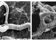 SEM images showing intertwined tubular filaments and surface debris at high magnification