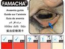FAMACHA Chart