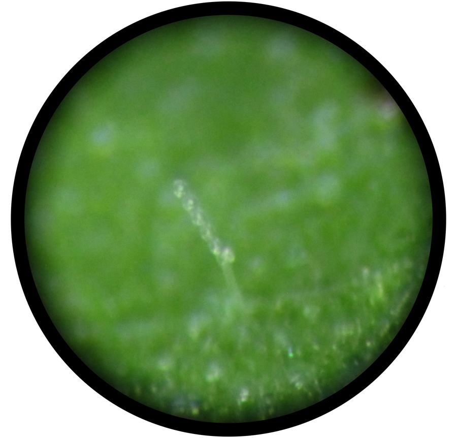 chain of five barrel-shaped spores (conidia) on a small conidiophore