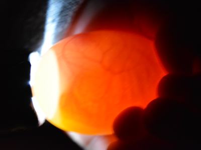Chicken egg candled against light showing translucent orange interior and veins