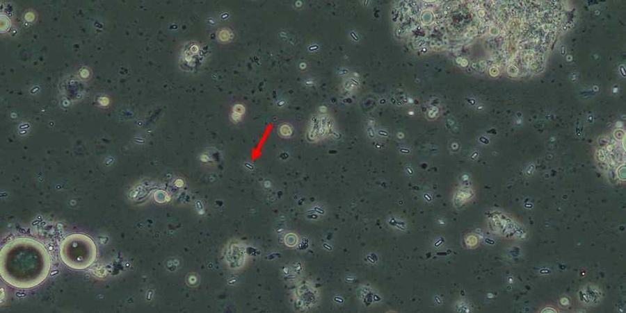 Spores of Nosema maddoxi, a microsporidian, infecting an adult BMSB. Spores are the small, cylindrical, capsule-shaped objects, one of which is indicated by arrow. Photograph taken using a microscope with phase-contrast at 40x. (Photo: Emily Ogburn)