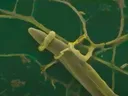 Hair shaft with yellow lice eggs (nits) attached to hair strands