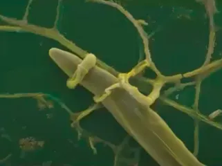 Hair shaft with yellow lice eggs (nits) attached to hair strands