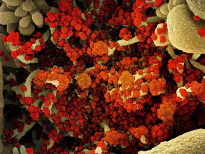 Covid-19 virus image