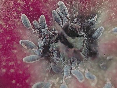 Oystershell scale on apple fruit