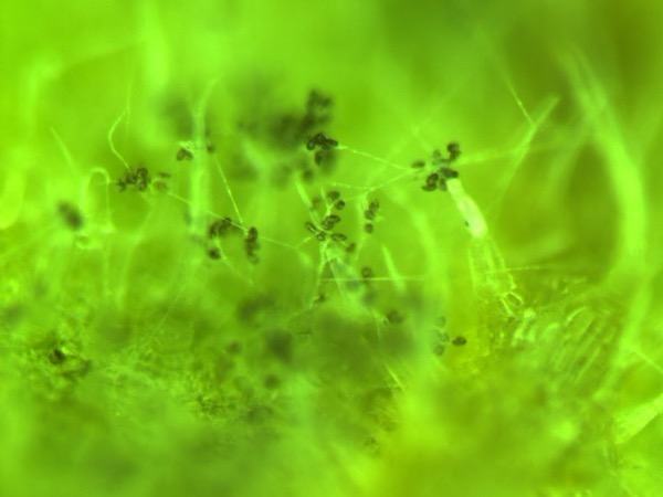 magnified sporangiophores