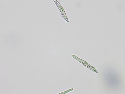 A microscopic image of the spores related to leaf spot disease.