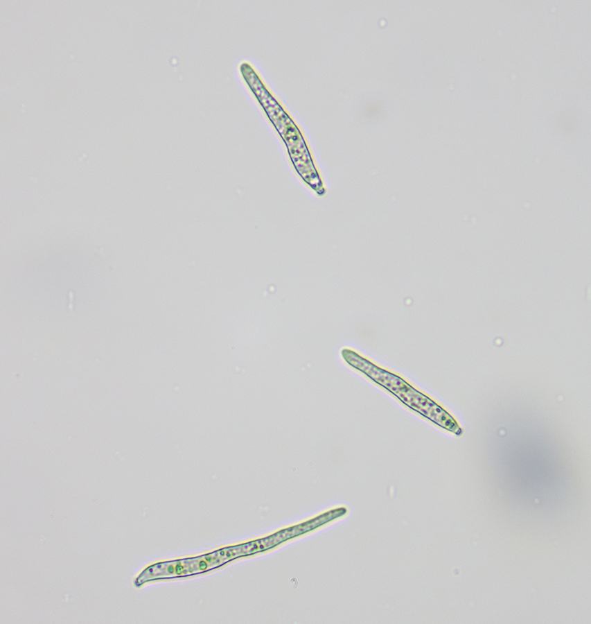 A microscopic image of the spores related to leaf spot disease.