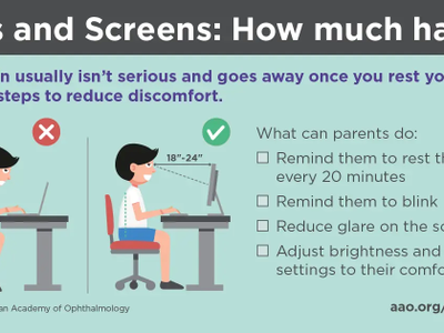 Child at computer 18–24 in away; rest eyes every 20 minutes; blink; reduce glare