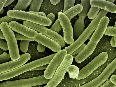 Rod-shaped bacteria clustered on a surface, scanning electron microscope view