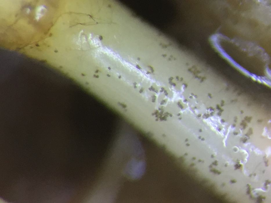 microscopic view of lesions