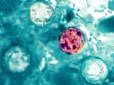 A microscopic image of Cyclospora cayetanensis, the parasite that causes cyclosporiasis.