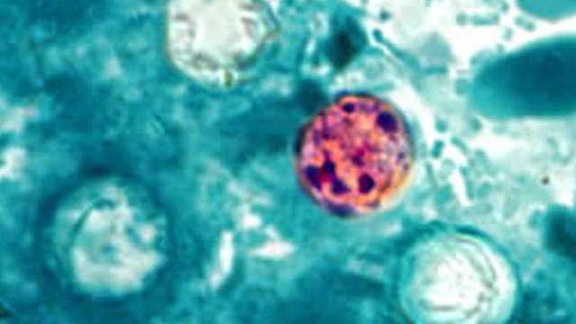 A microscopic image of Cyclospora cayetanensis, the parasite that causes cyclosporiasis.