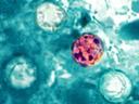 A microscopic image of Cyclospora cayetanensis, the parasite that causes cyclosporiasis.