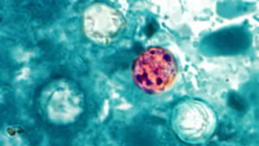 A microscopic image of Cyclospora cayetanensis, the parasite that causes cyclosporiasis.