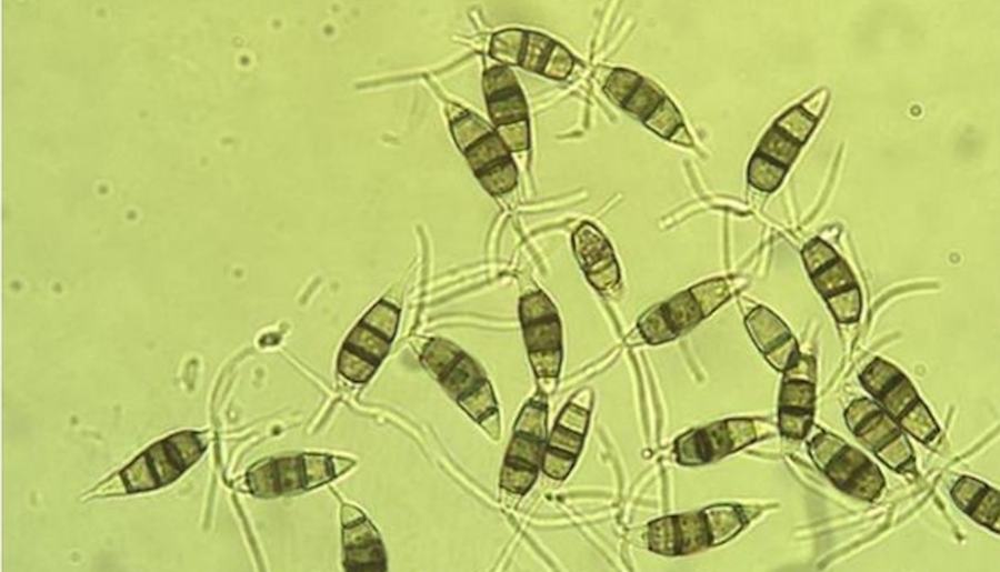Neopestalotiopsis, or "Neo-P," spore cells as seen through a microscope.