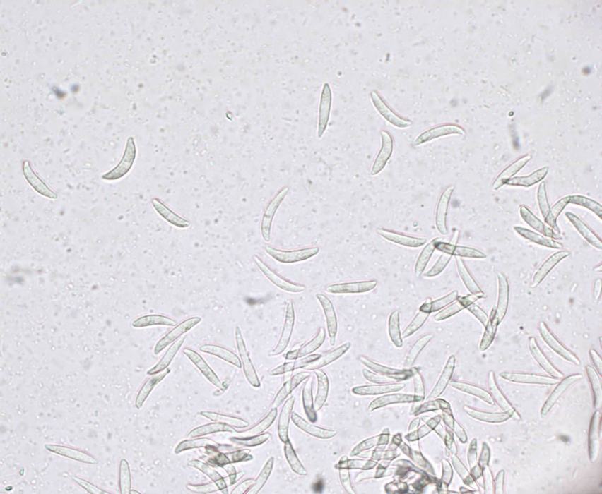 anthracnose spores