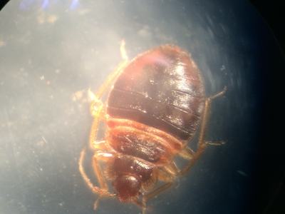 bedbug under a microscope