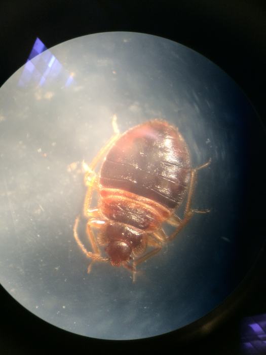 bedbug under a microscope
