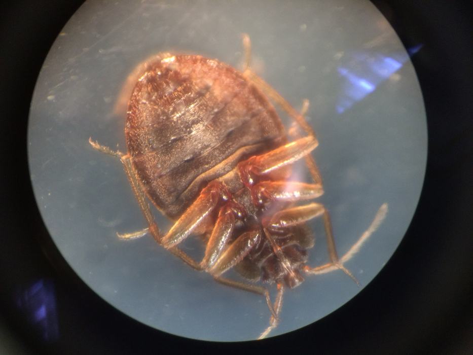 underside of bedbug under microscope