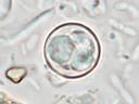 Cyclospora oocyst