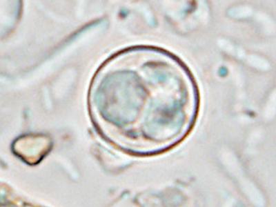 Cyclospora oocyst