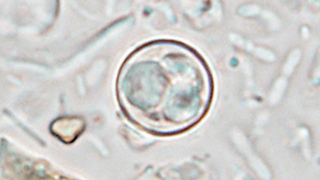 Cyclospora oocyst
